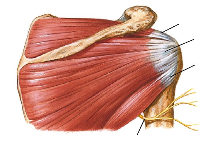 Алкоголизация Supraspinatus