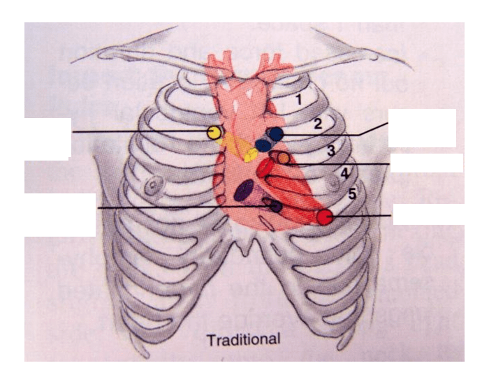 Point where. Heart Auscultation. Valve Auscultation. Heart Auscultation points. ERB point.