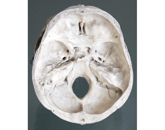 Черепно мозговую кость. Основание черепа изнутри анатомия. Кость основания черепа. Снимки основания черепа.