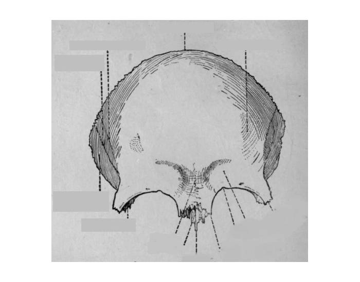 Лобные латынь. Лобная кость вид спереди вид снизу. Анатомия лобной кости. Лобная кость черепа анатомия. Глабелла лобной кости.